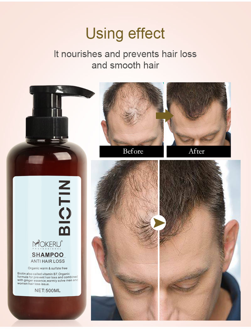 Champú para el cabello con biotina