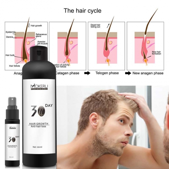 Herbal Hair Regrowth Oil