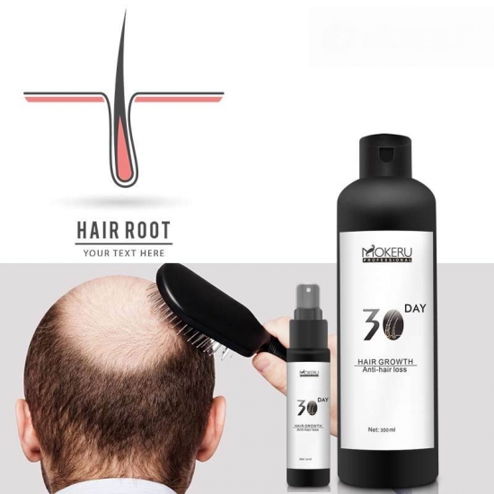 Herbal Hair Regrowth Oil